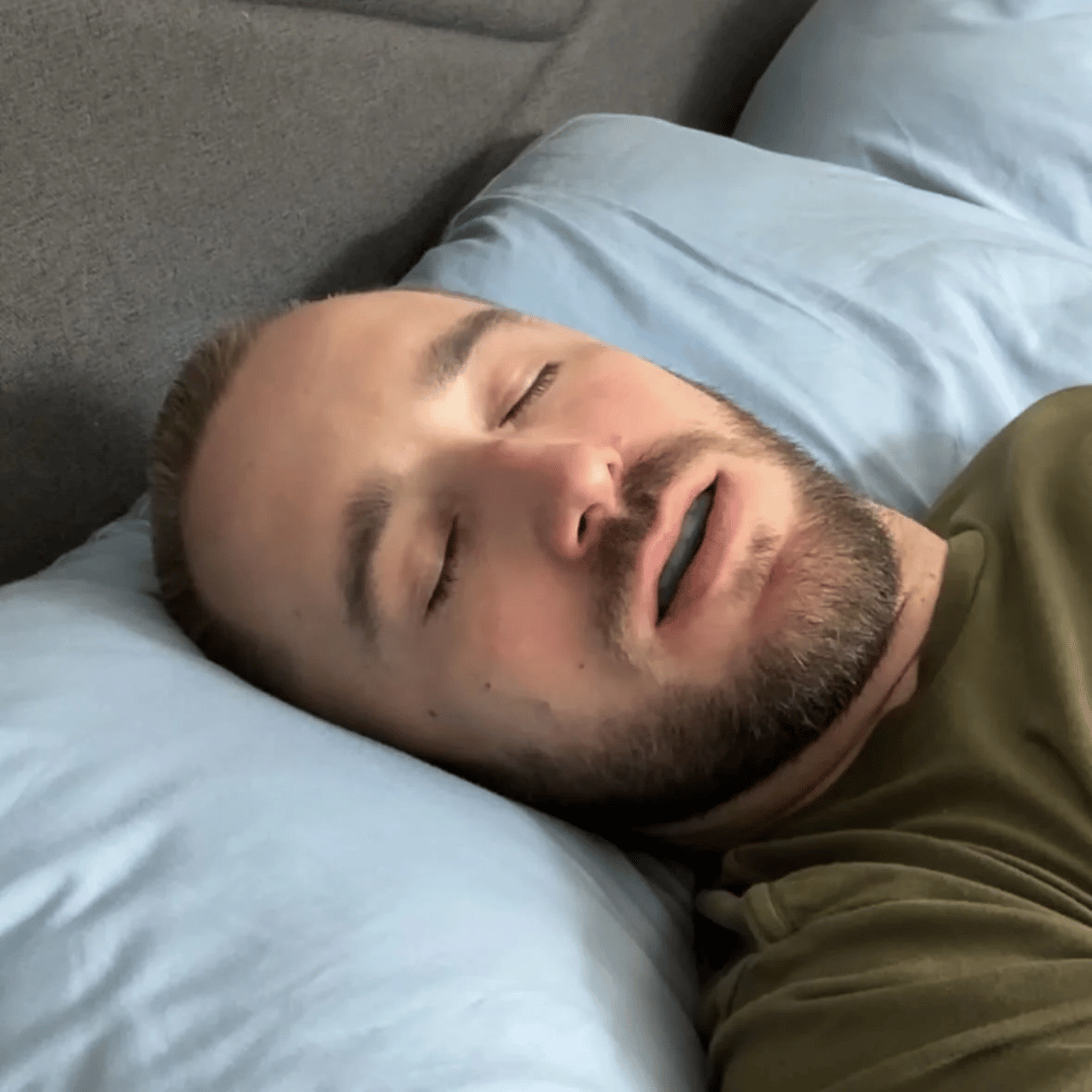 Nuraya Anti-Snoring Mouthpiece