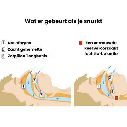 Nuraya Anti-Snurk Mondstuk